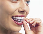 ZOOM Tooth Whitening | Porcelain Veneers | Fort Worth