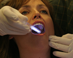 ZOOM Tooth Whitening | Porcelain Veneers | Fort Worth