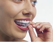 Orthodontics | Invisalign® Fort Worth TX | Arlington TX